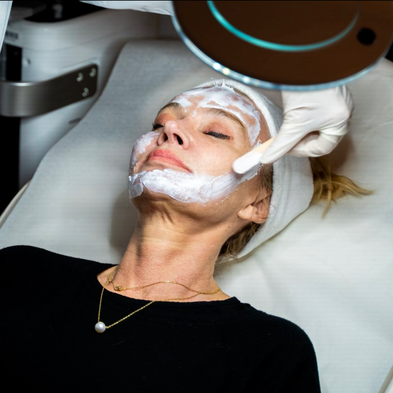 Laser CO2 Fractionné